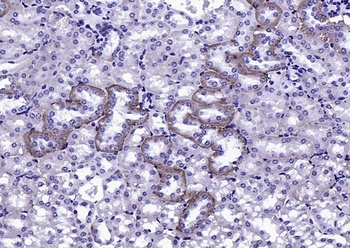 FGFR1/FGFR2 (phospho-Tyr463) antibody