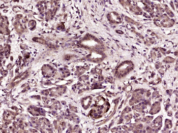 ABCG1 Rabbit Polyclonal Antibody