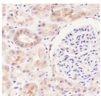 HDAC6 antibody