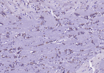 Acetyl CoA Carboxylase 1(ACC1) antibody