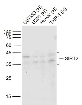 SIRT2 antibody