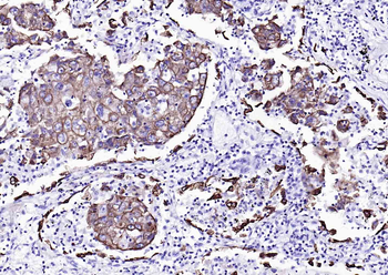 Cytokeratin 7 antibody