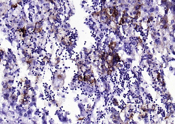 Cytokeratin 7 antibody