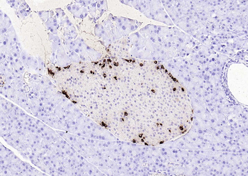 Goat Anti-Rabbit IgG H&L, HRP conjugated