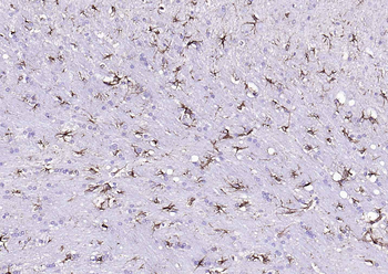 Goat Anti-Rabbit IgG H&L, HRP conjugated