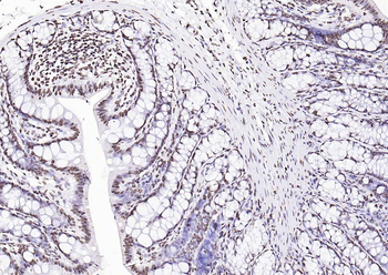 Goat Anti-Rabbit IgG H&L, HRP conjugated