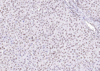 Goat Anti-Rabbit IgG H&L, HRP conjugated