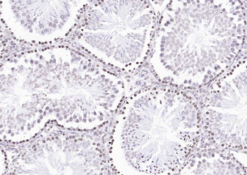 Goat Anti-Rabbit IgG H&L, HRP conjugated