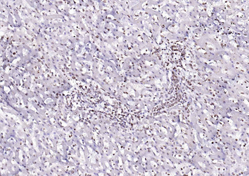 Goat Anti-Rabbit IgG H&L, HRP conjugated