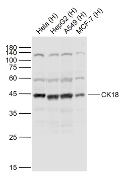 CK18 Rabbit Polyclonal Antibody