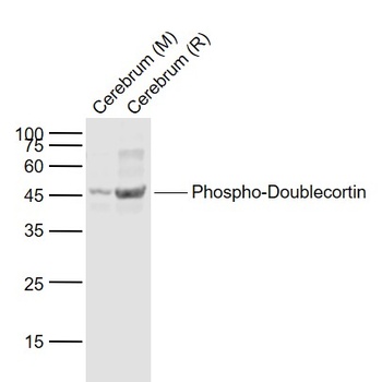 Doublecortin (phospho-Ser297) antibody