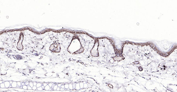 Bax antibody