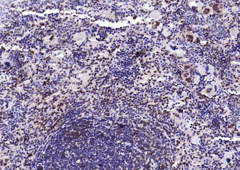 PSMA1 Antibody