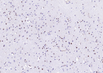 PSMA1 Antibody