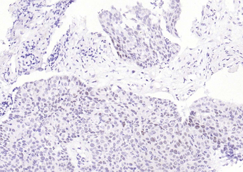 PSMA1 Antibody