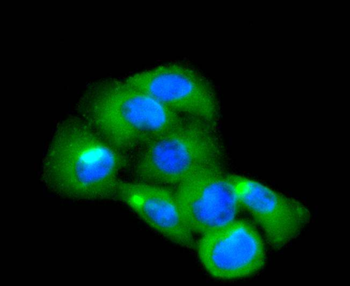 CD14 antibody