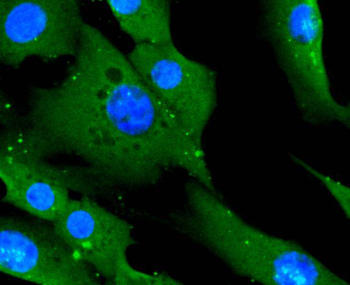 CD14 antibody