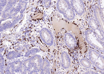 CD14 antibody