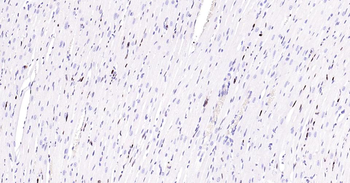 PCNA Antibody