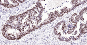 PCNA Antibody