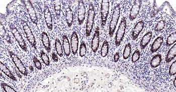 PCNA Antibody