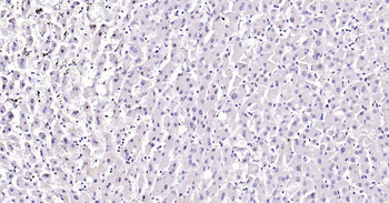 PCNA Antibody