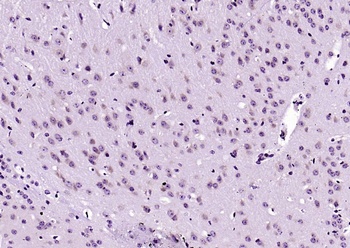 CD71 antibody