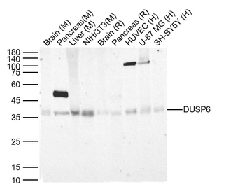 DUSP6 Recombinant Rabbit Monoclonal Antibody