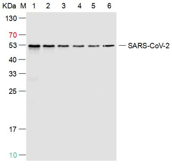 SARS-CoV-2 (2019-nCoV) Nucleocapsid Mouse Monoclonal Antibody