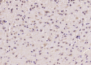 mTOR (phospho-Ser2481) antibody