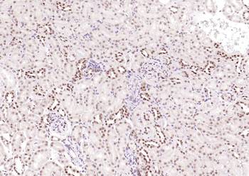 CSNK2B Antibody