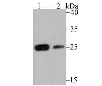 CSNK2B Antibody