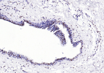 CSNK2B Antibody