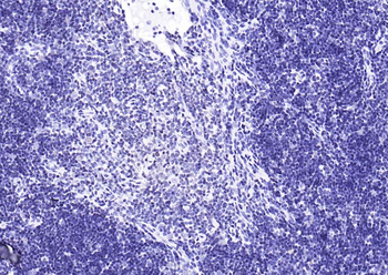 YY1 Antibody