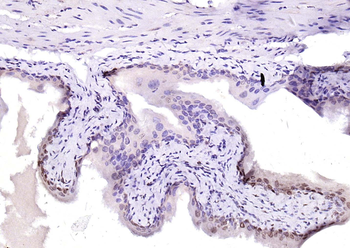 YY1 Antibody