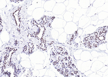 YY1 Antibody