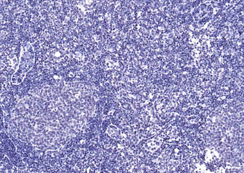 YY1 Antibody