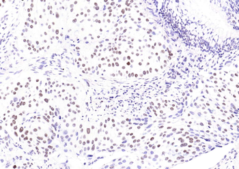 YY1 Antibody