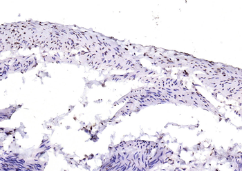 YY1 Antibody