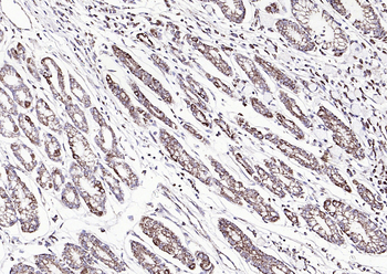 Phospho-Tie2 (Tyr992) Rabbit Polyclonal Antibody