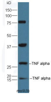 TNF alpha Rabbit Polyclonal Antibody