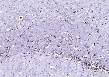 Streptavidin protein conjugated to HRP.