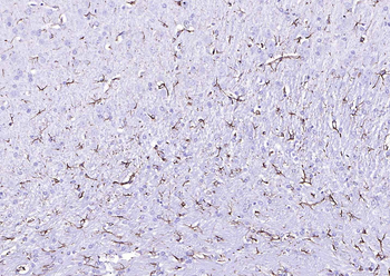 Streptavidin protein conjugated to HRP.