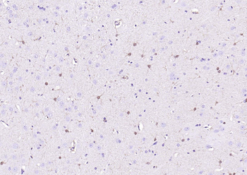 Streptavidin protein conjugated to HRP.