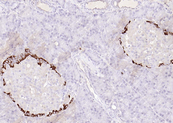 Streptavidin protein conjugated to HRP.