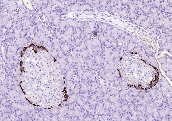 Streptavidin protein conjugated to HRP.