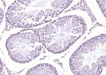 Streptavidin protein conjugated to HRP.