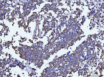Beclin 1 Antibody (monoclonal, 2D12A3)