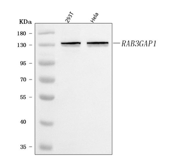 RAB3GAP1 Antibody