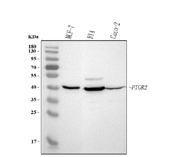 Anti-PTGR2 Antibody